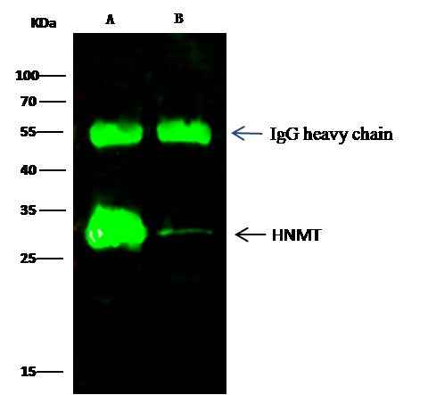 Anti-Human HNMT Antibody [A1275] - ABMIUM
