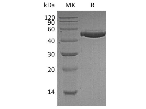 Recombinant Human Complement Factor H/CFH Protein (His Tag) - ABMIUM