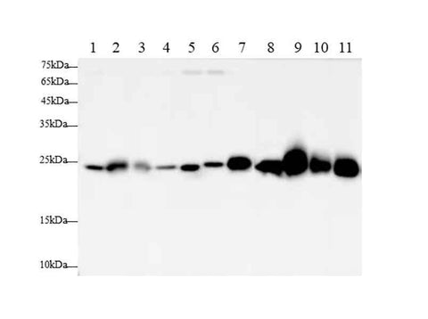 Anti-Human/Mouse/Rat SOD2 Antibody - ABMIUM
