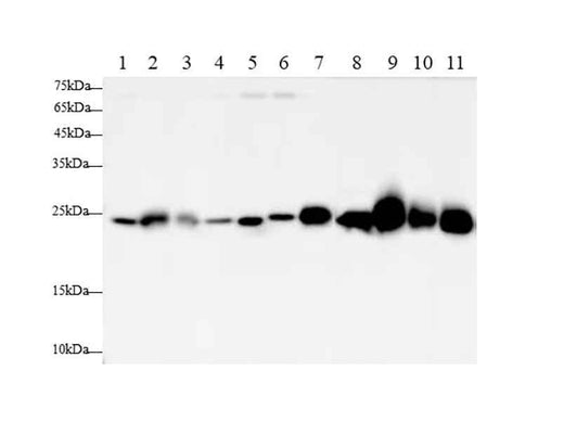Anti-Human/Mouse/Rat SOD2 Antibody - ABMIUM