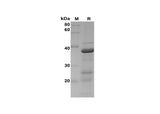 SDS-PAGE analysis of Rat BCL2 proteins, 2 μg/lane of Recombinant Rat BCL2 proteins was resolved with SDS-PAGE under reducing conditions, showing bands at 38 kDa.