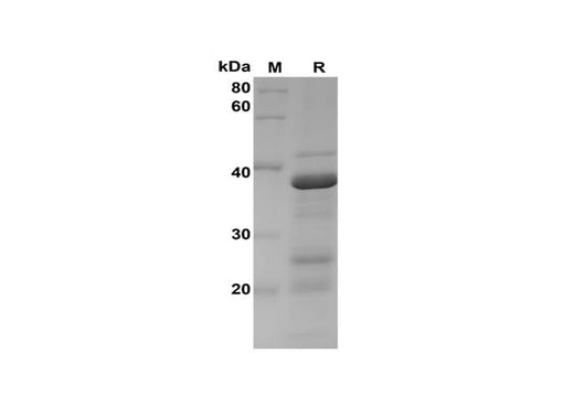 SDS-PAGE analysis of Rat BCL2 proteins, 2 μg/lane of Recombinant Rat BCL2 proteins was resolved with SDS-PAGE under reducing conditions, showing bands at 38 kDa.
