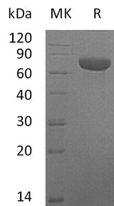 Recombinant Mouse TSLP Receptor/CRLF2 Protein (Fc Tag) - ABMIUM