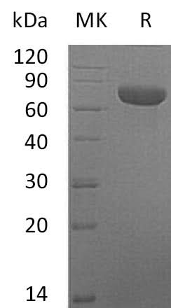 Recombinant Mouse TSLP Receptor/CRLF2 Protein (Fc Tag) - ABMIUM