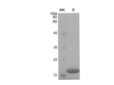 SDS-PAGE analysis of Mouse RBP1 proteins, 2 μg/lane of Recombinant Mouse RBP1 proteins was resolved with SDS-PAGE under reducing conditions, showing bands at 17 kDa.