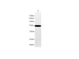 Anti-Mouse DAO Antibody - ABMIUM