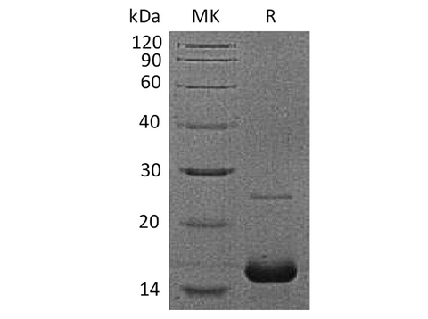 Recombinant Human Myoglobin/MB Protein (His Tag) - ABMIUM