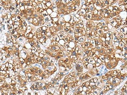 Anti-Human/Mouse/Rat PHLDA3 Antibody