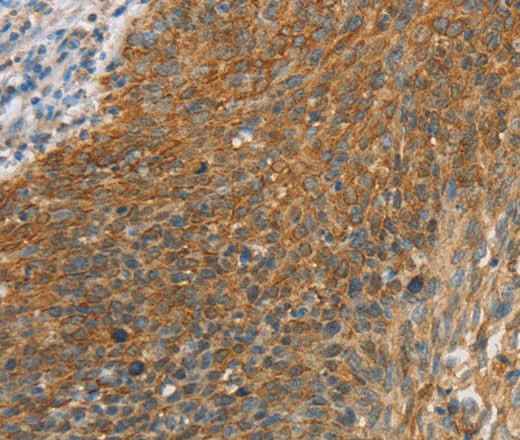 Anti-Human/Mouse/Rat ERK 3 Antibody