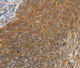 Anti-Human/Mouse/Rat ERK 3 Antibody - ABMIUM