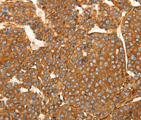 Anti-Human/Mouse SFRP1 Antibody - ABMIUM
