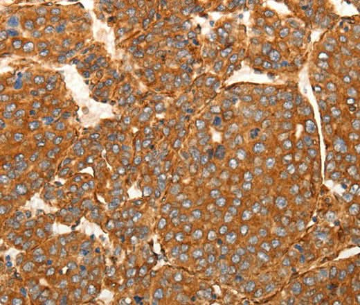 Anti-Human/Mouse SFRP1 Antibody - ABMIUM