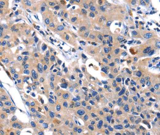 Anti-Human/Mouse/Rat MMP16 Antibody