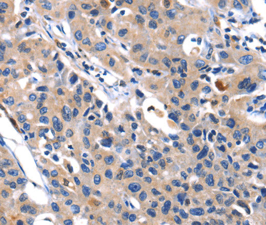 Anti-Human/Mouse/Rat MMP16 Antibody - ABMIUM