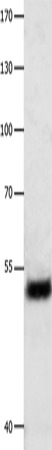 Anti-Human/Mouse/Rat EEF1G Antibody - ABMIUM