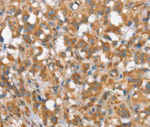 Anti-Human/Mouse CSMD1 Antibody