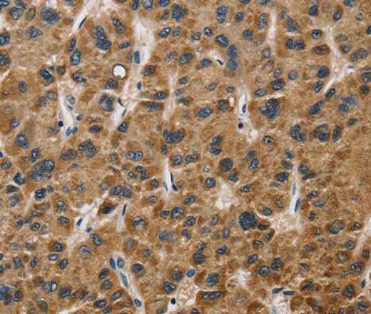 Anti-Human/Mouse/Rat IL19 Antibody