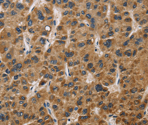Anti-Human/Mouse/Rat IL19 Antibody - ABMIUM