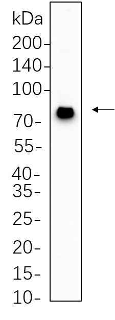 Anti-Human/Mouse/Rat MeCP2 Antibody [B619] - ABMIUM