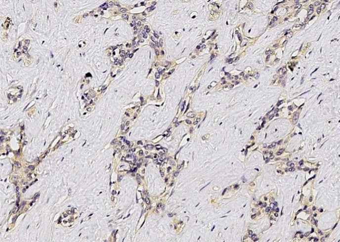 Anti-Human ASGR1 Antibody [B123] - ABMIUM