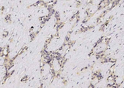 Anti-Human ASGR1 Antibody [B123] - ABMIUM