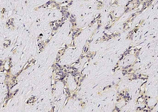 Anti-Human ASGR1 Antibody [B123] - ABMIUM