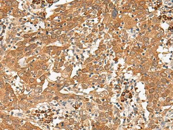 Anti-Human/Mouse/Rat GFI1 Antibody