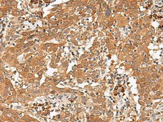 Anti-Human/Mouse/Rat GFI1 Antibody
