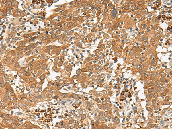 Anti-Human/Mouse/Rat GFI1 Antibody - ABMIUM