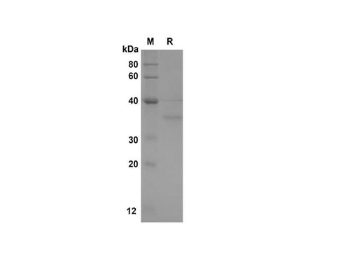 SDS-PAGE analysis of Mouse Angiogenin proteins, 2 μg/lane of Recombinant Mouse Angiogenin proteins was resolved with SDS-PAGE under reducing conditions,, showing bands at 36 kDa.