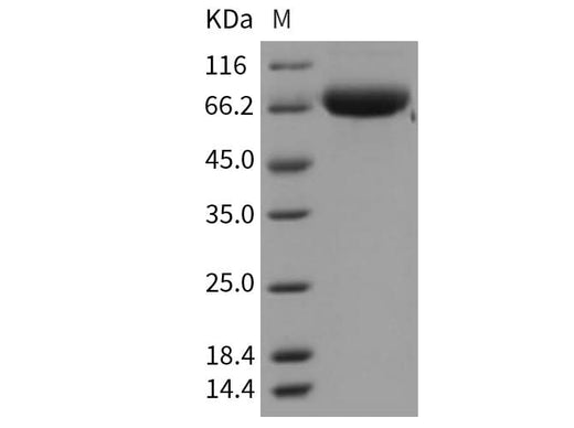 > 91 % as determined by reducing SDS-PAGE.