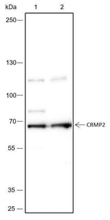 Anti-Human/Rat/Mouse CRMP2 Antibody [A446]