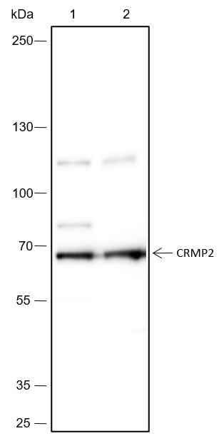 Anti-Human/Rat/Mouse CRMP2 Antibody [A446] - ABMIUM