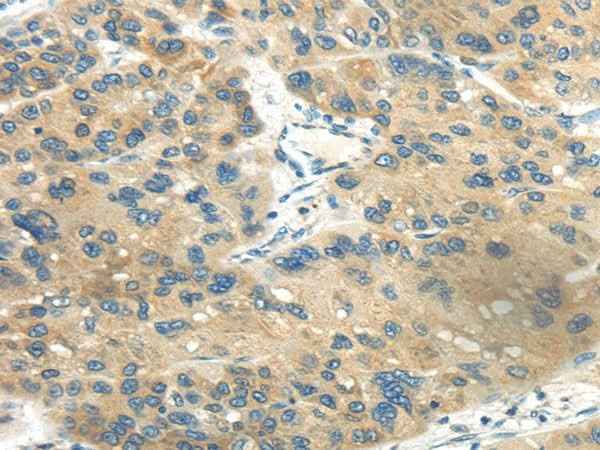 Anti-Human CD70 Antibody