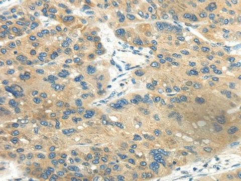 Anti-Human CD70 Antibody - ABMIUM