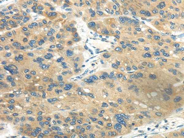 Anti-Human CD70 Antibody - ABMIUM
