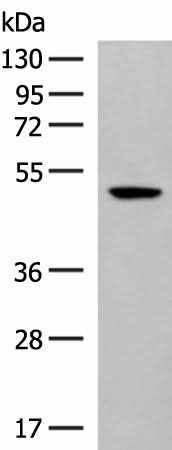 Western blot analysis of Hela cell lysate using GPR142 Polyclonal Antibody at dilution of 1:400