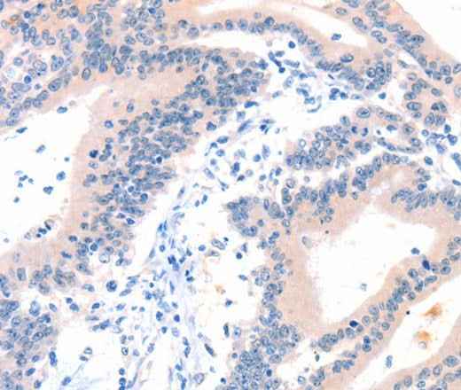 Anti-Human/Mouse ITGA6 Antibody