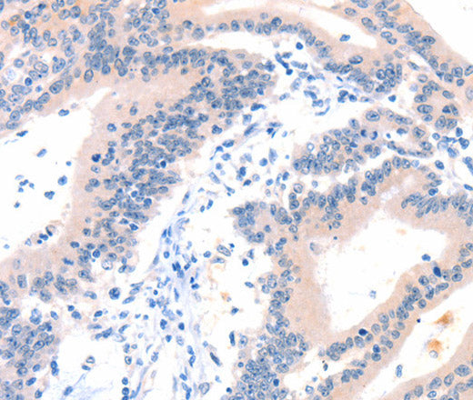 Anti-Human/Mouse ITGA6 Antibody - ABMIUM