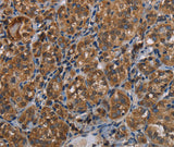 Anti-Human LLGL1 Antibody - ABMIUM