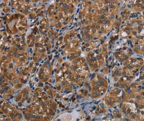 Anti-Human LLGL1 Antibody