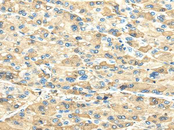 Anti-Human/Mouse/Rat INHBB Antibody