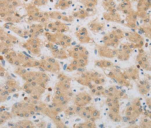 Anti-Human/Mouse/Rat NBN Antibody