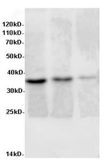 Western Blot analysis of Rat liver, Rat lung tissue and Jurkat cells using AIMP2 Polyclonal Antibody at dilution of 1:600