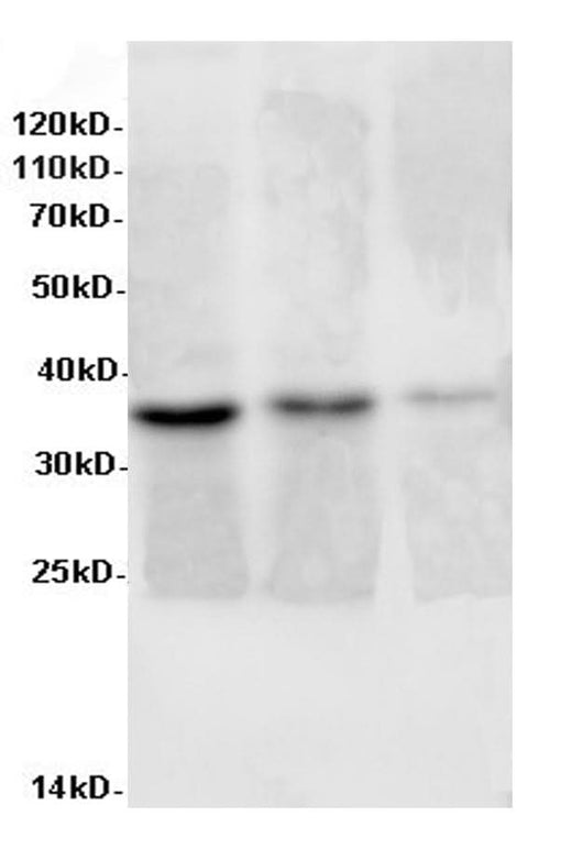 Western Blot analysis of Rat liver, Rat lung tissue and Jurkat cells using AIMP2 Polyclonal Antibody at dilution of 1:600