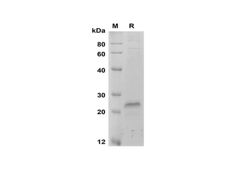 SDS-PAGE analysis of Human VEGF proteins, 2 μg/lane of Recombinant Human VEGF proteins was resolved with SDS-PAGE under reducing conditions, showing bands at 18-24 kDa.