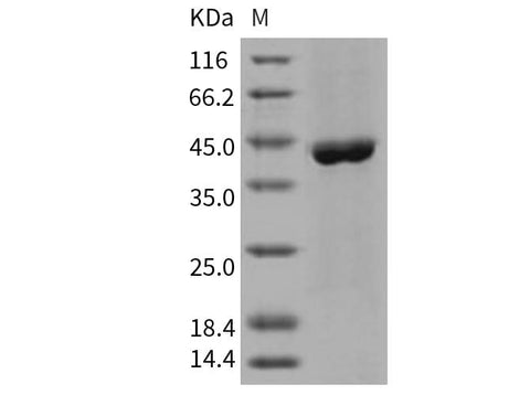 Recombinant Human ACY1/Aminoacylase-1 Protein (His Tag) - ABMIUM