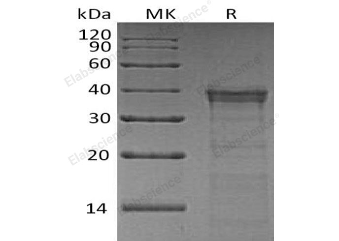 Recombinant Human Cathepsin L2/CTSL2 Protein (His Tag) - ABMIUM