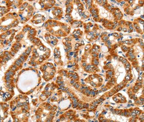 Anti-Human AIM2 Antibody