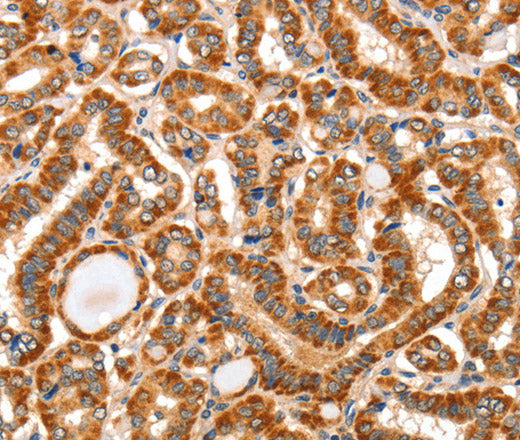 Anti-Human AIM2 Antibody - ABMIUM